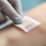 Jak zrobić opatrunek na oparzenia – skuteczne metody i praktyczne porady